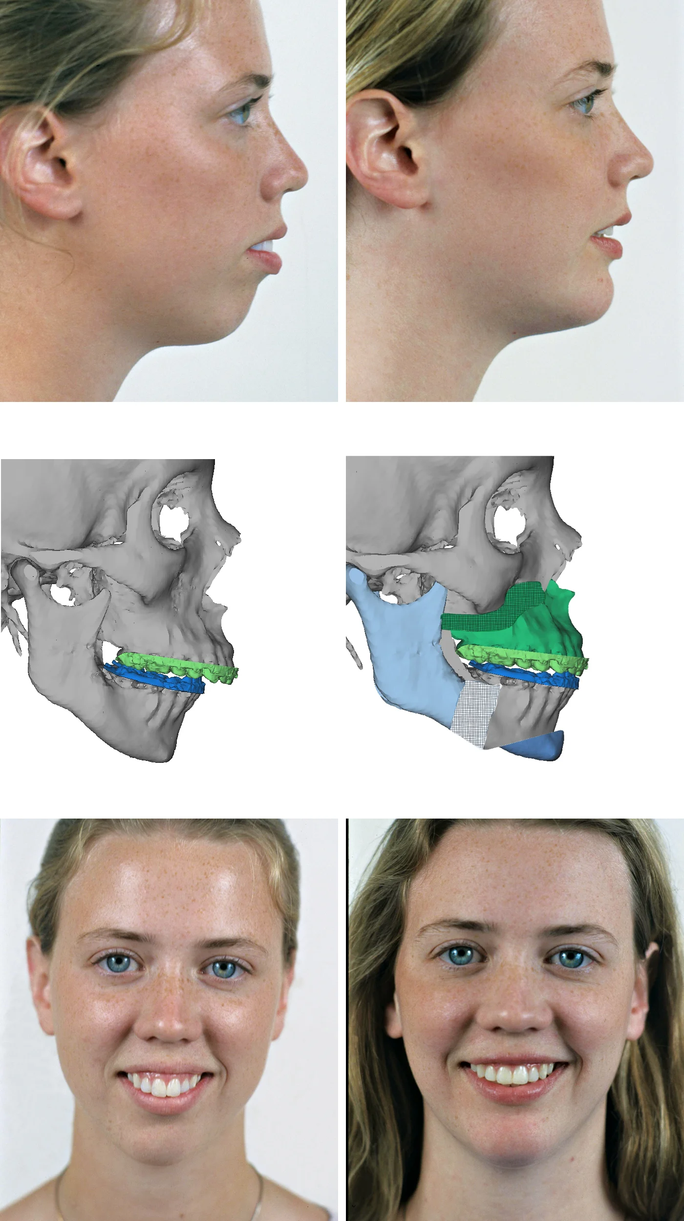 best-Jaw-surgeon-in-Mumbai-dr-tofiq-bohra 2-min