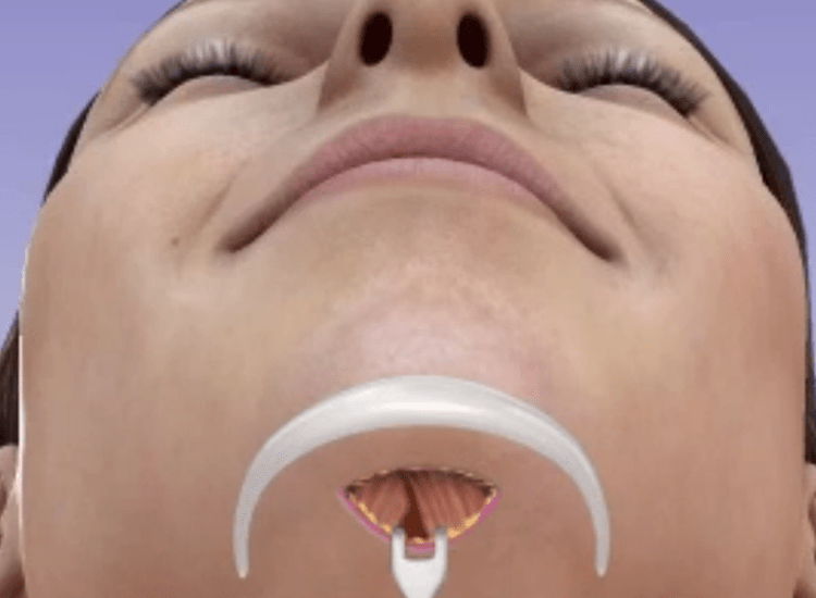 Best-Chin Surgeon-in Mumbai-dr-Tofiq bohra 1-min