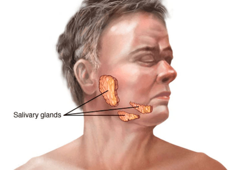 Best-Oral-Treatment-in-Mumbai-dr-Tofiq-Bohra 1-min