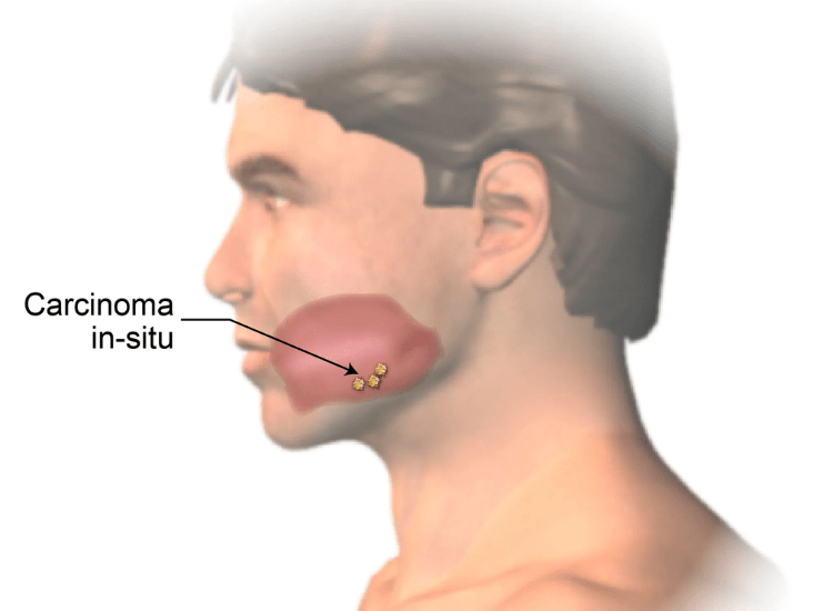 Best-Oral-Treatment-in-Mumbai-dr-Tofiq-Bohra 1-min