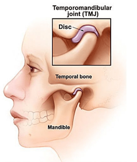 best-tmj-disorder-treatment-specialist-In-mumbai-dr-tofiq-bohra