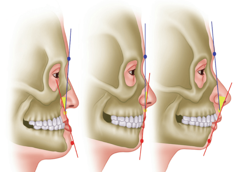best-Jaw-surgeon-in-Mumbai-dr-tofiq-bohra 2-min
