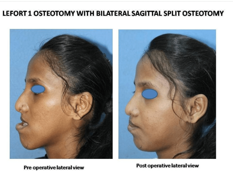 best-Jaw-surgeon-in-Mumbai-dr-tofiq-bohra 2-min