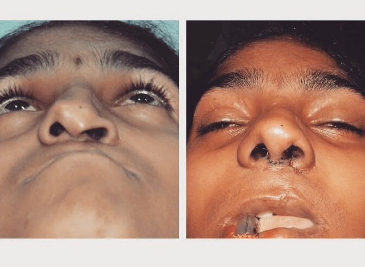 dr-Tofiq-bohra-Best Nose -Surgeon-in-Mumbai-3-min