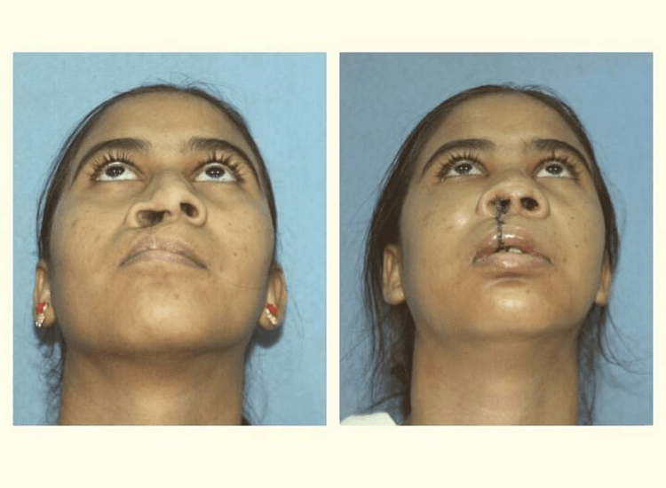 dr-Tofiq-bohra-Best Nose -Surgeon-in-Mumbai-3-min