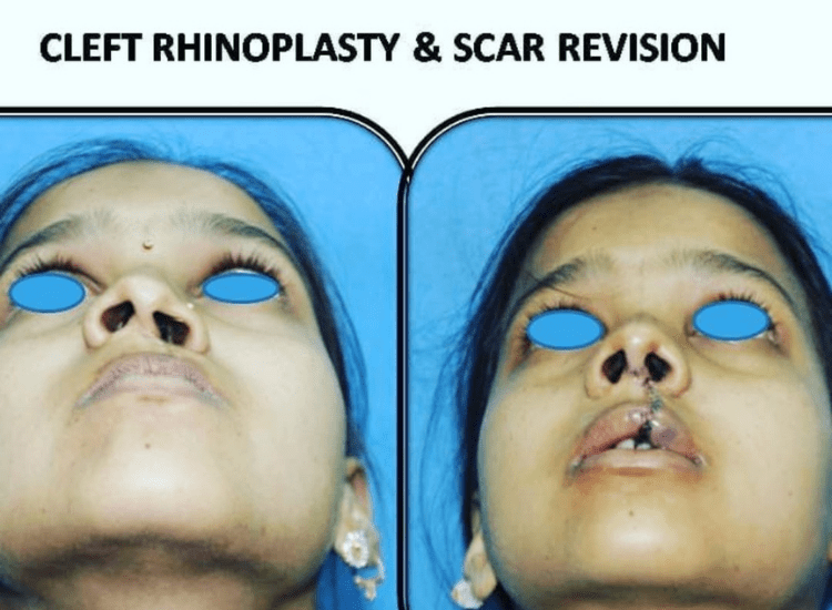 dr-Tofiq-bohra-Best Nose -Surgeon-in-Mumbai-3-min