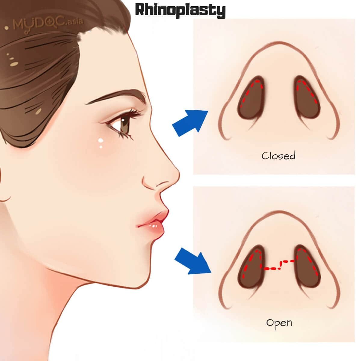 dr-Tofiq-bohra-Best Nose -Surgeon-in-Mumbai-7-min