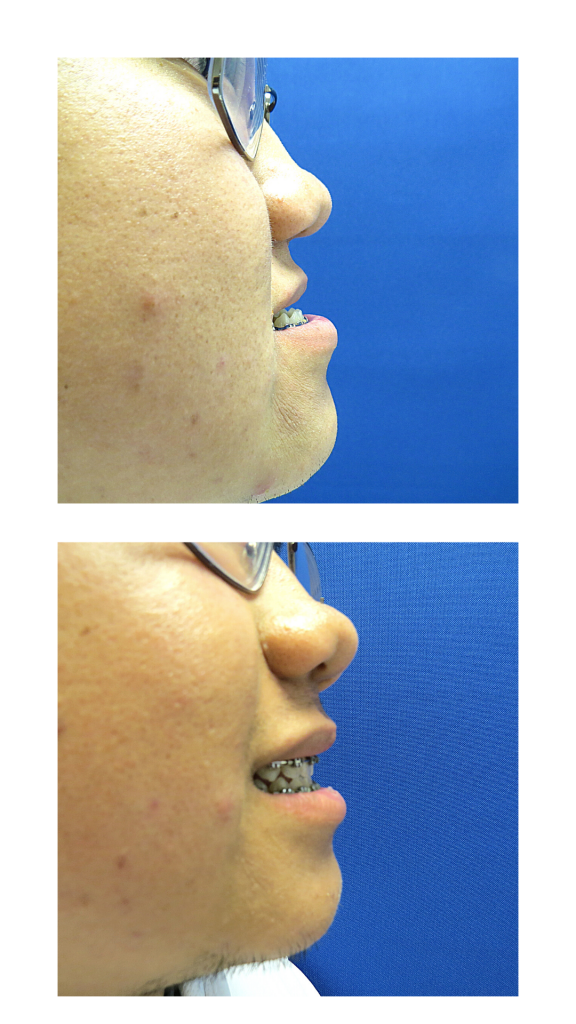 best-oral-surgeon-in-mumbai-for-jaw-surgery